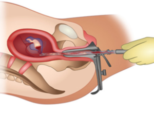 MTP Center at Devi Ratna Multispeciality Hospital.